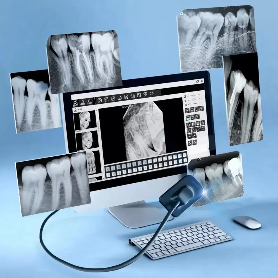 30% Off Medical Dental Xray imaging system Sensor Intraoral Digital Dental RVG X-Ray Radiographic Sensor With Good Price