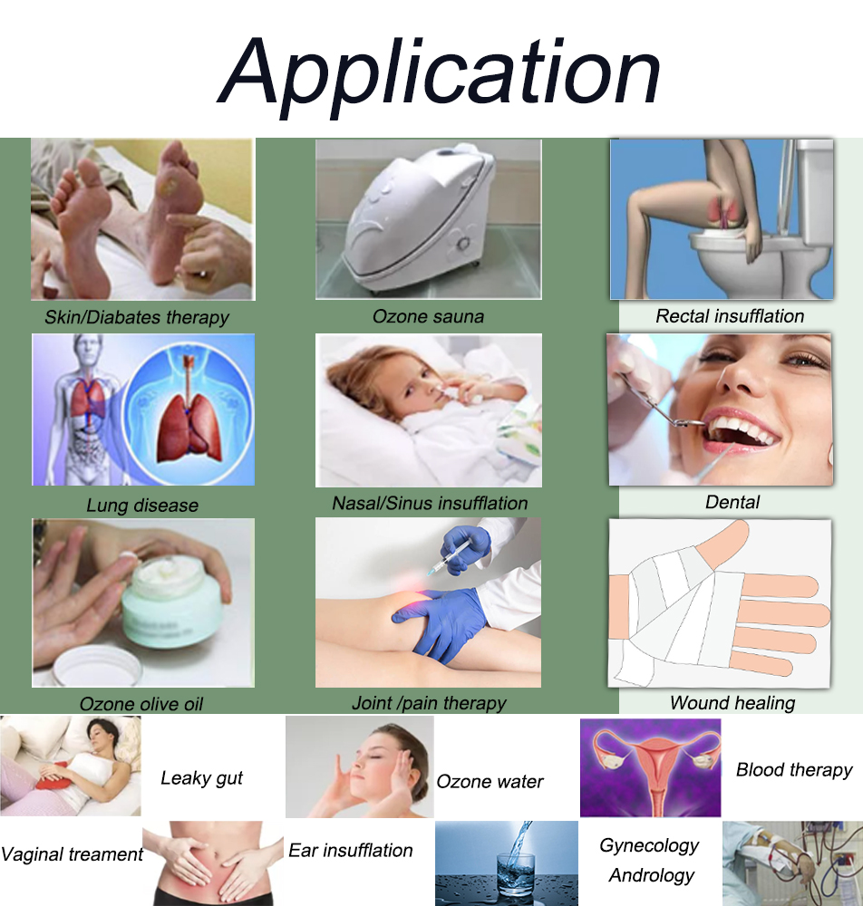 High Repurchase Rate and Fine Quality AOT-MD-500 medical grade ozone generator 6 H176ef848a2ff487aaad8b526440841950