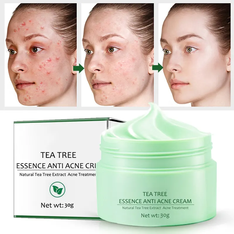 Etiqueta privada profissional da pele anti acnes reparação do rosto da árvore do chá verde creme & loção (nova)