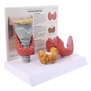 KyrenMed Thyroid Pathological Model Thyroid <strong>Larynx</strong> Diseases Educational Model Nodule Goiter Thyroiditis Mastoid Cancer - Product Image 1