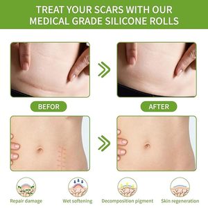 Silicone vết sẹo tấm (1.6x120 Roll-3M) y tế có thể giặt tái sử dụng cho c-phần phẫu thuật ghi sẹo lồi mụn loại bỏ tấm - Product Image 3