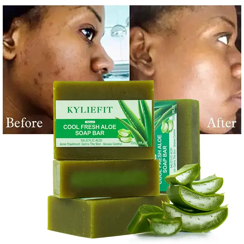 Commercio all'ingrosso Private Label Natural Organic Clearing macchia rimozione sapone di bellezza sbiancante cura l'acne sapone per il viso