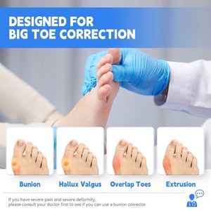 Универсальный корректор Bunion-Регулируемая шина для пальцев ног с силиконовыми подушечками (1 шт., серый) - Product Image 5