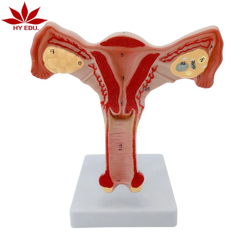 Modelo de anatomía reproductora interna femenina, modelo de estructura reproductora de ovario uterino