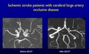 Perangkat EECP terapi fisik dan rehabilitasi untuk kardiovaskular, PHP, kegagalan hati/serangan, ginjal, ED,stroke, cedera - Product Image 5