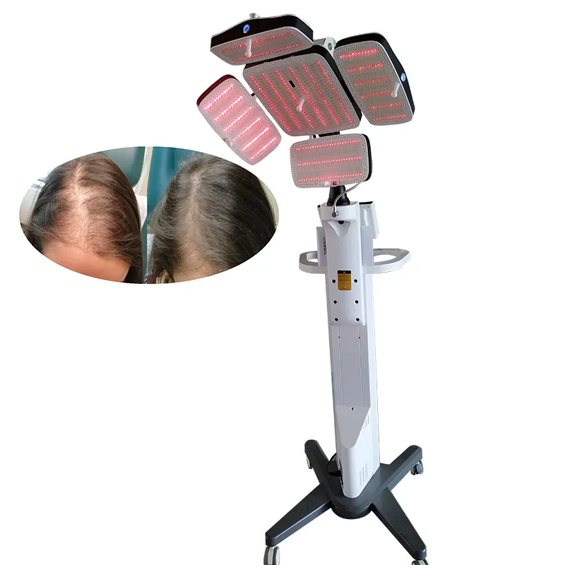Máquina de crecimiento de cabello 650nm PDT LED con láser frío para pérdida de cabello en clínica Beauty Spa Centro de implantes capilares