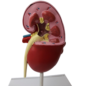医学のための病理学的および健康的な腎臓解剖学的モデル - Product Image 2