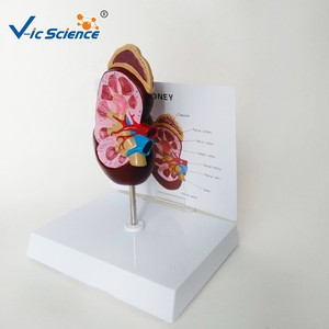 Medical Teaching Urinary System Model Human Anatomy Kidney Model Kidney Diseased Model