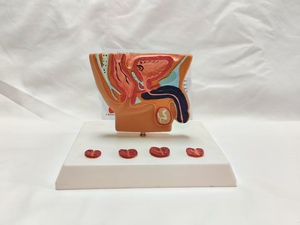 Human Male Abdominal Cavity Anatomical Model for Prostate &amp; Bladder Health Doctor Patient <strong>Explanation</strong> for Medical Teaching - Product Image 2