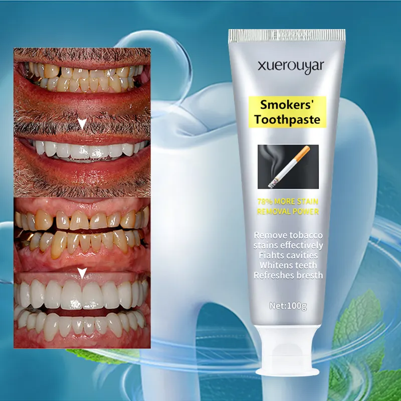 Dentifricio per fumatori Best Teeth Whitening Private Label all'ingrosso anticavity Fresh Breath Mint dentifricio sbiancante per denti