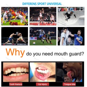 Miệng bảo vệ Mouthguard biểu tượng tùy chỉnh thể thao đấm bốc bóng đá bóng rổ MMA kẹo cao su lá chắn gumshield miệng bảo vệ - Product Image 5