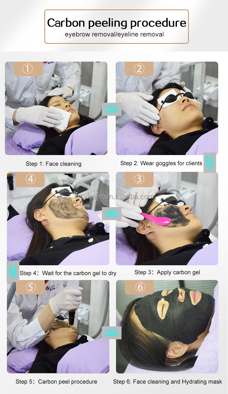 Лазер Nd Yag переключателя Microblading q