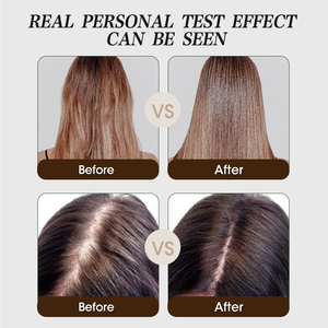 Private Label Gezonde Natuurlijke Biologische Haarverzorging Olie Controle Anti Verlies Hergroei Theeboom Gember Haargroei Shampoo Set - Product Image 6