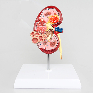 医学のための病理学的および健康的な腎臓解剖学的モデル - Product Image 3
