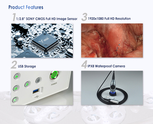 YKD-9001E Advance Equipamento Médico Integrado Universal Histeroscopia <span class=keywords><strong>Set</strong></span> Laparoscópica Endoscópica Camera Machine System