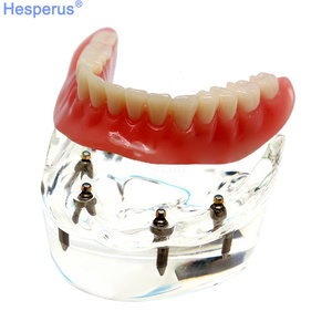 Natural Large Standard <strong>Tooth</strong> Model for Brushing Training and Practice Dental Model - Product Image 4