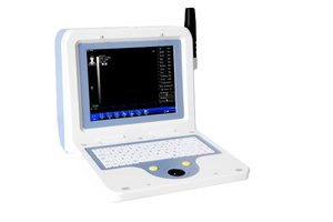 Oftalmik veteriner ultrason tarayıcı A/B tarayıcı ABS-300 AB tarama test ekipmanları oftalmoloji cihazı biyometri göz tarayıcı - Product Image 3