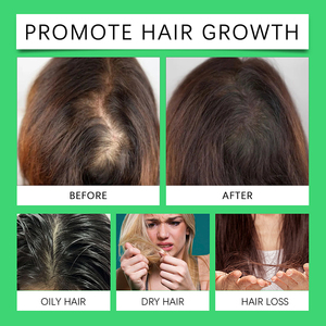 プライベートラベル育毛オイルナチュラルオーガニックヘアリペアは、育毛のためのバタナオイルの損失を減らします - Product Image 4