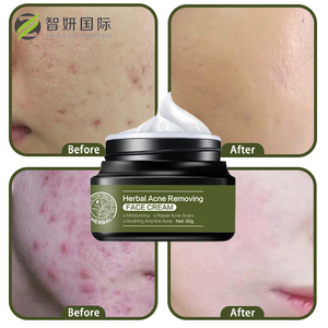 Nhãn hiệu riêng chăm sóc da sửa chữa chống mụn loại bỏ mụn trứng cá mặt Kem Cây Trà thảo dược chăm sóc mụn trứng cá Kem - Product Image 4