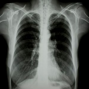 Pellicola a raggi <span class=keywords><strong>X</strong></span> con pellicola medica Laser opaca bianca di vendita calda per stampanti Laser in fogli - Product Image 3