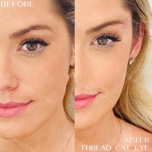 Rejeon vẻ đẹp cá nhân chăm sóc da hilos tensores Meso fio de lông mày nâng 2-trong-1 Mono/vít/lốc xoáy pdo chủ đề nâng - Product Image 1