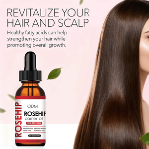 Huile de rose musquée Huile de base pour soins de la peau essentielle à base de graines Maintient la stabilité Réparations Estompe les marques d'acné Huile pour le corps entier - Product Image 5