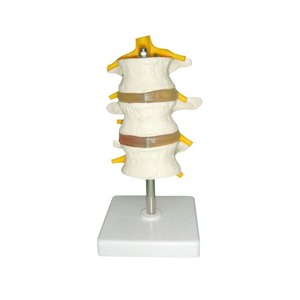 Lumbar Vertebrae Model with Spinal Cord and Spinal <strong>Nerve</strong> - Product Image 2