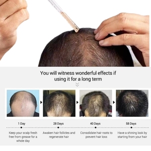 Organik anti-saç dökülmesi tedavisi biberiye saç büyüme yağı Serum hindistan cevizi yağı tabanlı zulüm-ev kullanımı için ücretsiz - Product Image 6