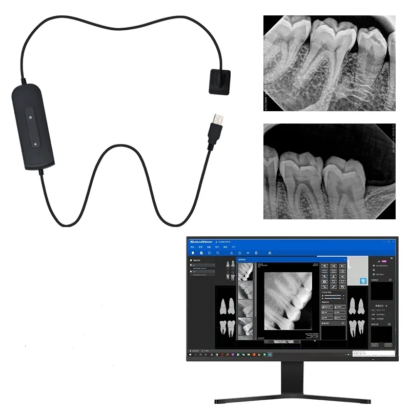 Dental-RVG-Sensor Digitalbildsystem Intraoral-X-Ray-Sensor Digital Sensor CMOS