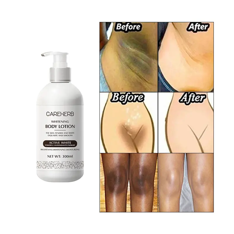Various new retinol AHA vitamina c hidratante clareamento da pele das mulheres loção corporal axila axilas clareamento creme