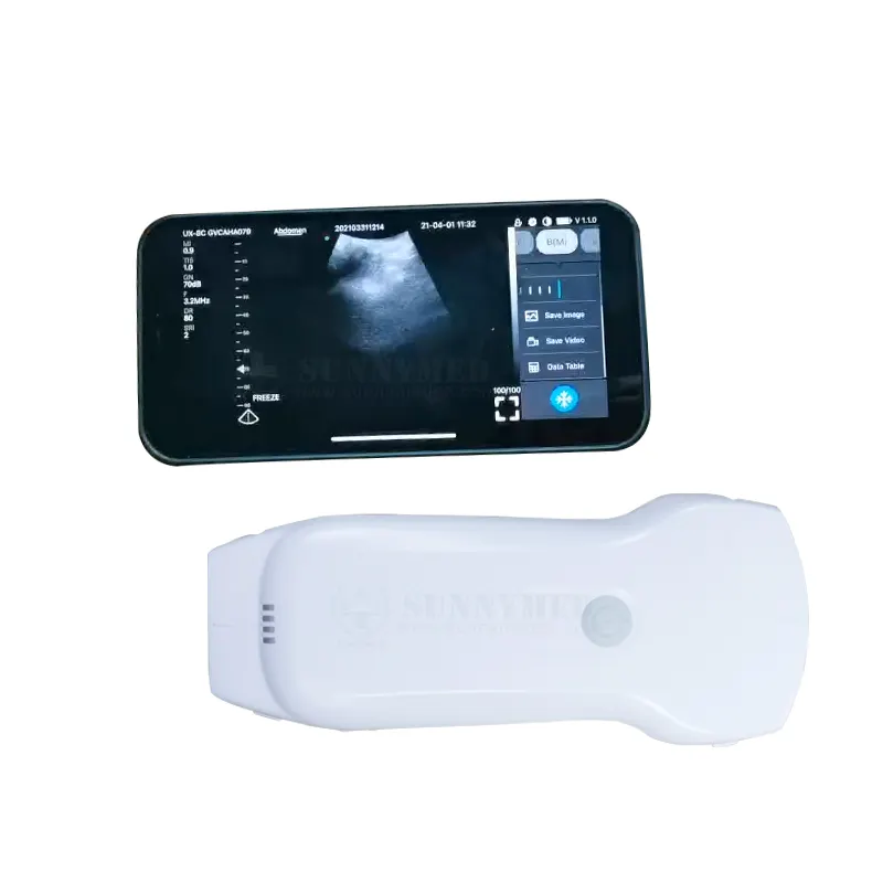 SY-A053C Double Head Wireless 3 in 1 Color Doppler Ultrasound Scanner Linear/Convex/Phased probe