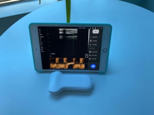 无线ios/安卓usb线性超声探头医用高频探头价格出售 - Product Image 6