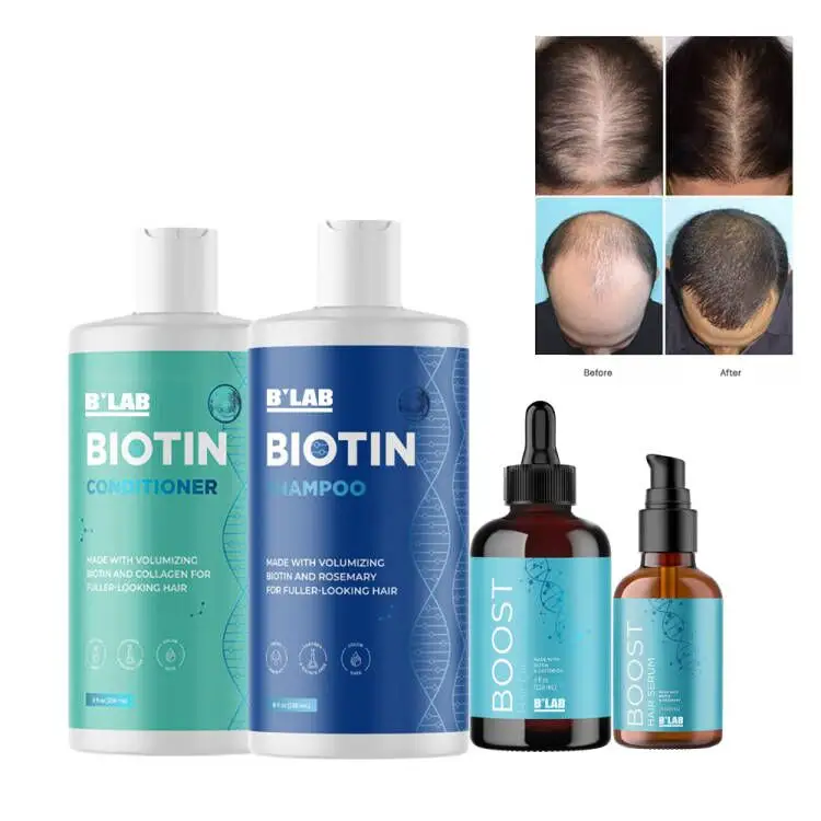 Conjunto profissional anti-queda de cabelo, shampoo de biotin, etiqueta privada, produto de crescimento do cabelo