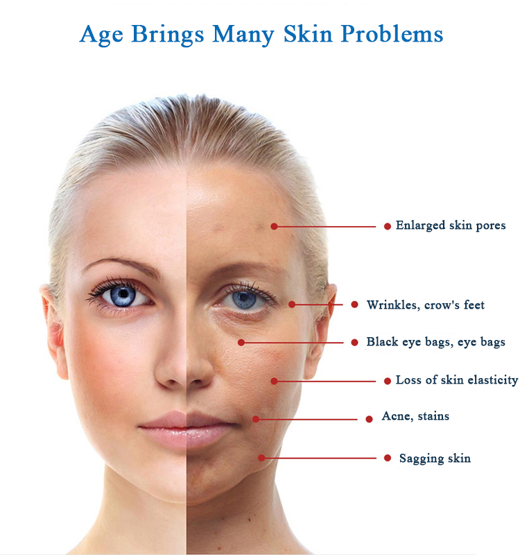 Korea Oxgyen Dome Face Care Machine Skin Care Equipment With Pdt Led Light Therapy Skin Rejuvenation Wrinkle Removal