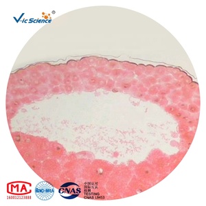 Động vật học kính hiển vi chuẩn bị Slide động vật mô học Slide Set sinh học Giun đất kính hiển vi Slide - Product Image 1