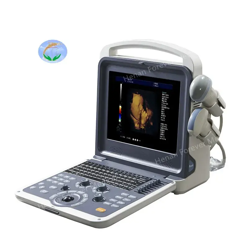 4D Full Digital Color Doppler Ultrasound Diagnostic System Preço competitivo 6 idiomas Ultrassom portátil