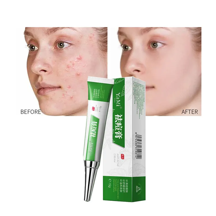 private label organic effective best dark spots treatment acne pimples cream skin care wholesale removal acne face cream
