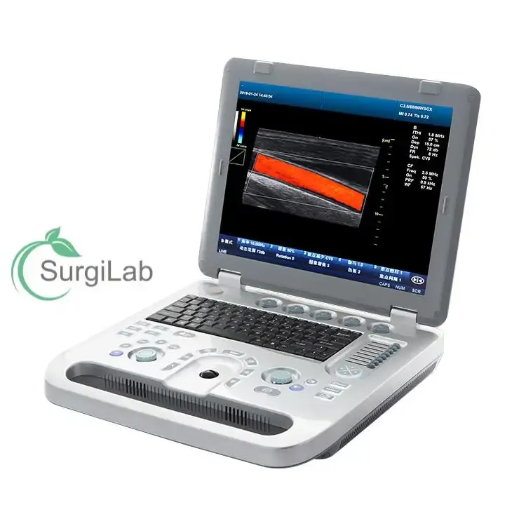 Dispositivo de ultrasonido médico portátil Karestar 3D 4D Ultrasonido Color Doppler Máquina de ultrasonido portátil