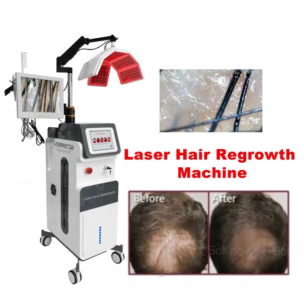 5-in-1 haargröße sauerstofftherapie maschine rot led haarwachstumsrestauration niedriges niveau laserlicht für haarverlust