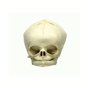 Kyrenmed mô hình sọ thai nhi Mô hình giải phẫu sọ y tế thai nhi <span class=keywords><strong>40</strong></span> Tuần Mô Hình Bộ Xương modelo de craneo thai nhi - Product Image 2