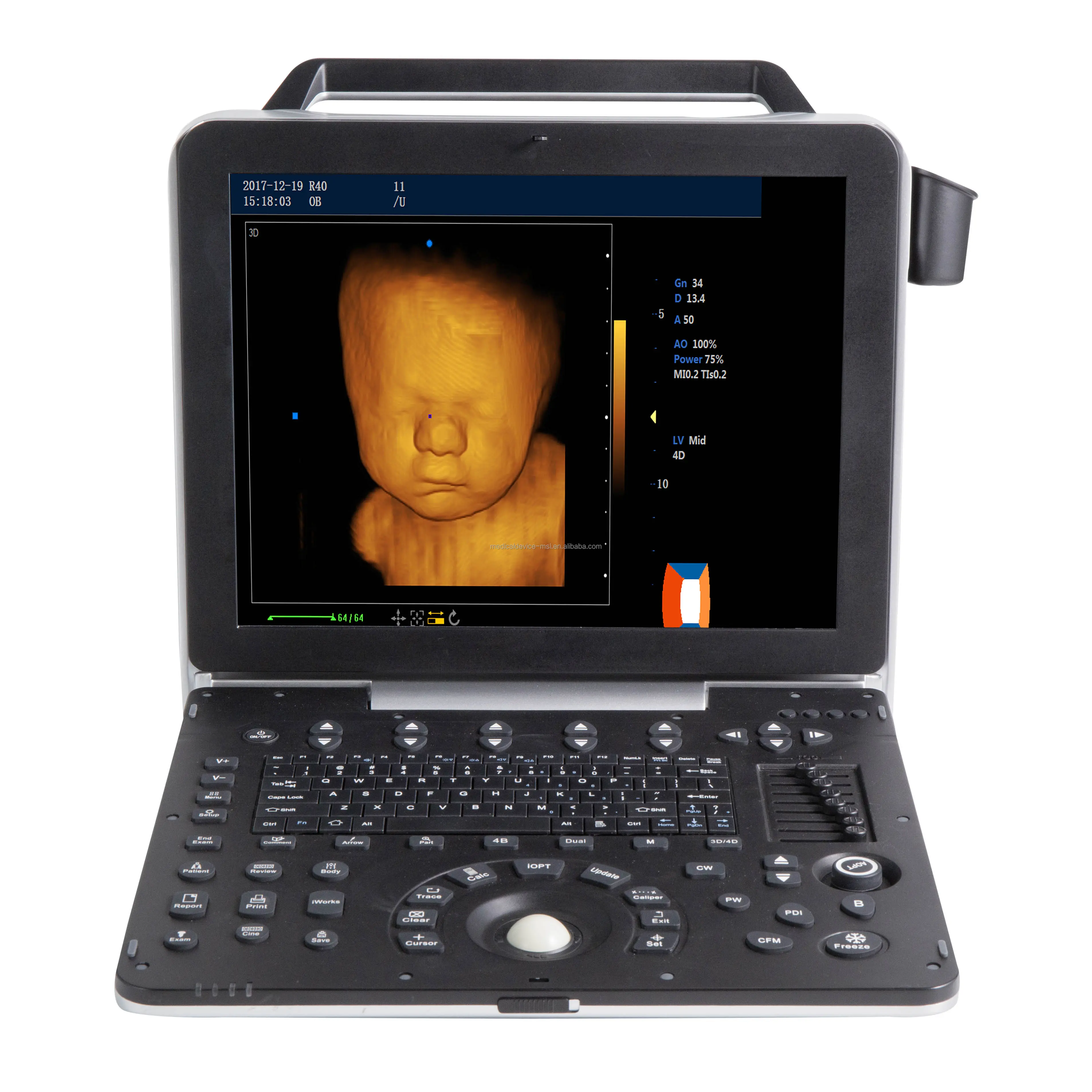 4D 5D цветной Ультразвуковой доплеровский ультразвуковой сканер для медицинского использования
