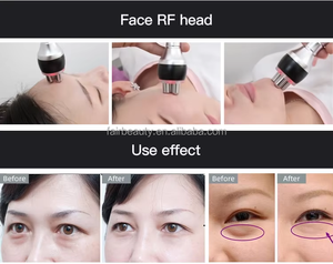 Feier một Xách Tay 4in1 40k chân không chất béo mất Cavi mặt cổ nâng làm săn chắc mắt nâng chăm sóc da Máy Spa homeuse kim8 - Product Image 6