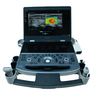 Melhor Preço de Alta Qualidade <span class=keywords><strong>Mindray</strong></span> MX7 Portátil Full Digital Color Doppler Ultrasound Máquina com Função Estável - Product Image 6