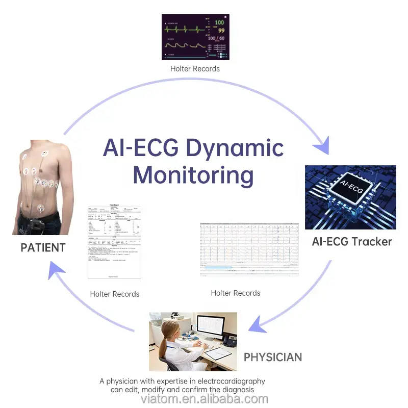 Wellue TH12 24 giờ ECG holter màn hình di động tim mạch holter ECG máy 12 kênh giá thấp năng động ECG Chẩn Đoán từ xa