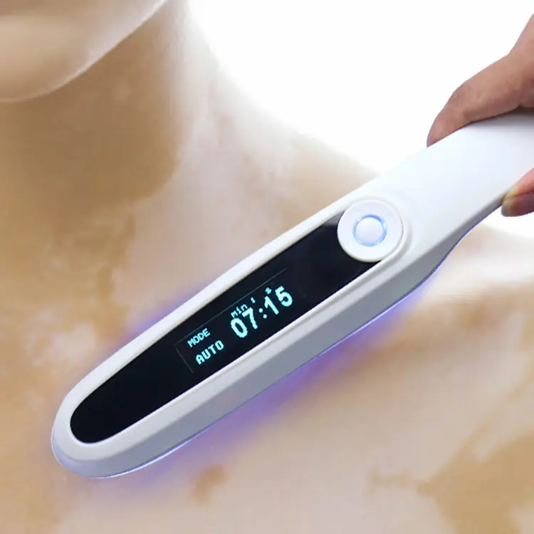 Equipamento médico Yonker, lâmpada portátil de 311nm para tratamento de psoríase e vitiligo, terapia por luz uvb, fototerapia 308nm