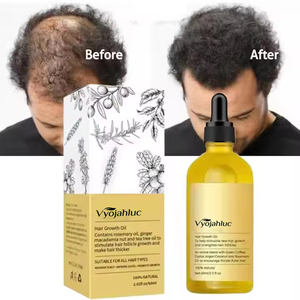 Частная Марка, 100% веганское натуральное средство для восстановления волос, органические масла для быстрого волос, масло розмарина, масло для роста волос - Product Image 1