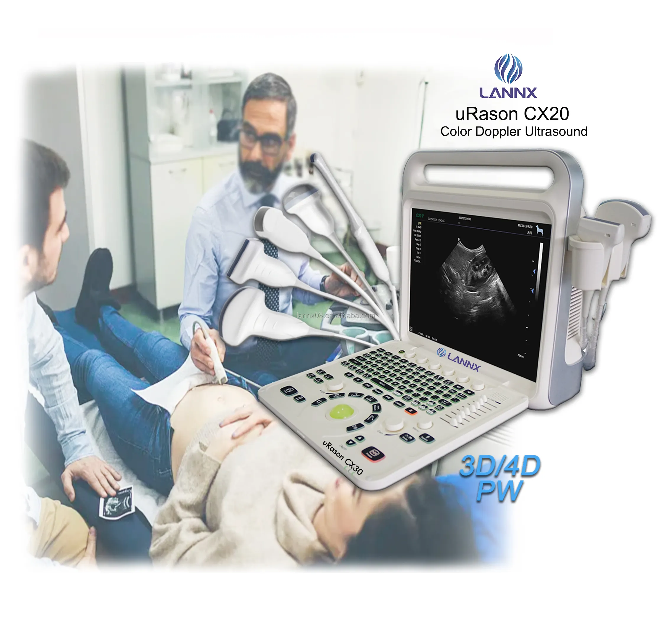 LANNX uRason CX30 offerta calda 128 permanenti applicazione clinica macchina a ultrasuoni Doppler a colori 3D ecocardiografia
