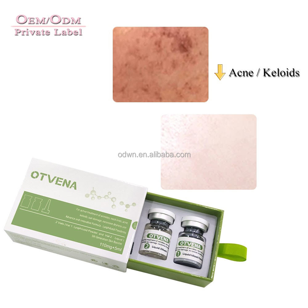 OTVENA SERUM