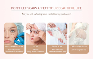 Y tế cấp Silicone sẹo băng (có thể giặt 2in1) cho phẫu thuật sẹo lồi & hypertrophic SARS-Beauty & chăm sóc cá nhân sản phẩm - Product Image 4