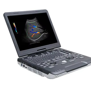 Портативный ультразвуковой сканер - Product Image 1